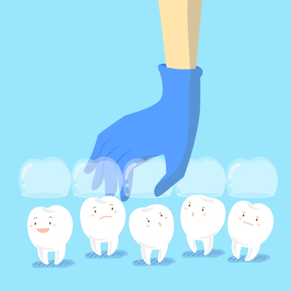 Invisalign Huntsville, AL