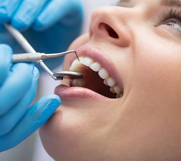 Huntsville Dental Bonding