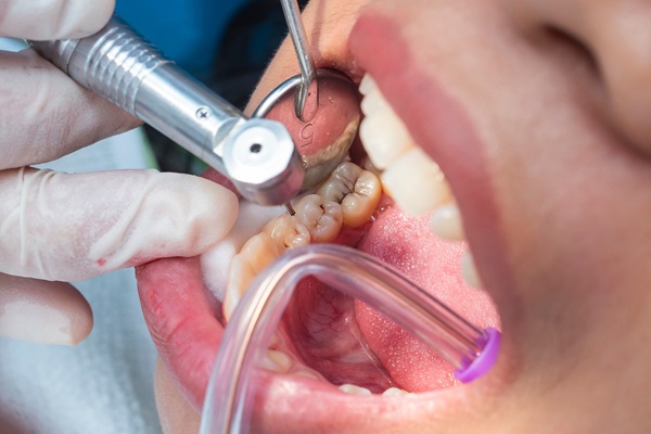 Oral Hygiene Tips From A General Dentist To Help Your Smile Shine