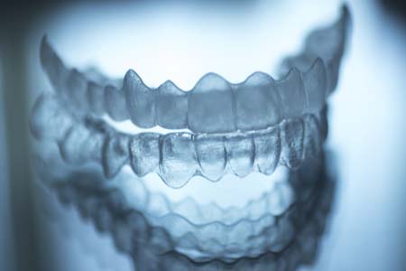 An Invisalign® Dentist Takes These Steps To Create The Aligners