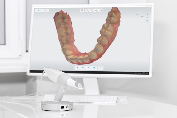 Digital Scanning ITero For Invisalign And Clear Braces