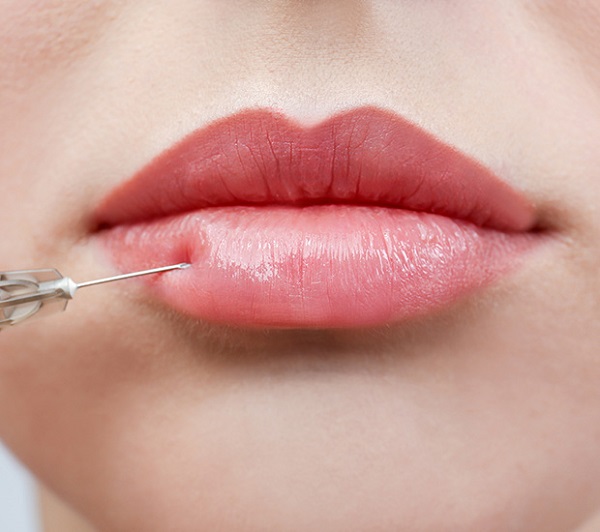 How Often Do I Need Botox Or Juvederm Treatment From My Cosmetic Dentist?
