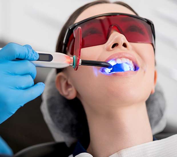 Huntsville Professional Teeth Whitening