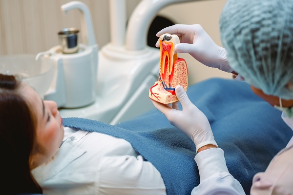 Tips To Prepare For Root Canal Treatment