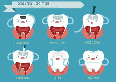 Get The Facts About Root Canal Therapy