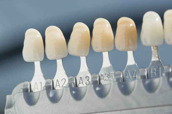 Ask A Cosmetic Dentist About The Dental Veneers Procedure